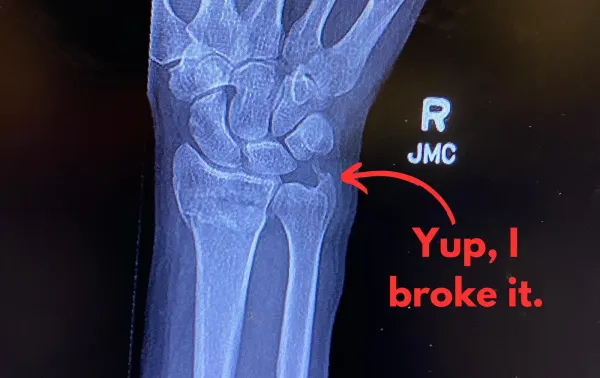 Well Shit, I Just Broke My Wrist